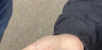 Wapello County Residents Urged to Report Storm Damage ASAP